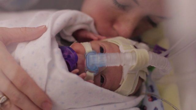 Video: “La milagrosa vida de Ward Miles, un bebé prematuro”.